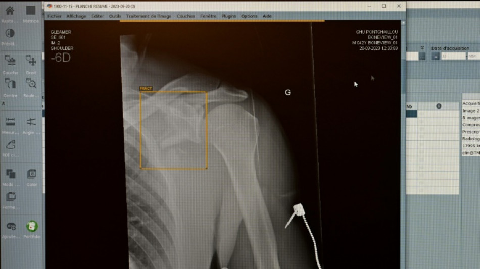 TÜV-Verband: Weniger Röntgengeräte mit Mängeln - Risiken bleiben aber