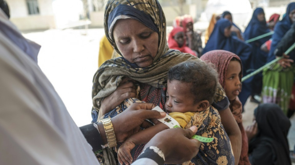S&eacute;cheresse: la malnutrition explose en Ethiopie, notamment chez les enfants, selon une ONG