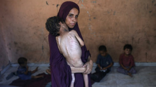 NGO says starving Gaza children too weak to cry