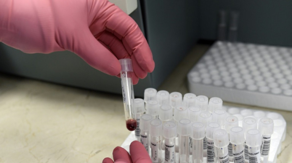 Les m&eacute;dicaments contre le VIH: de l'AZT &agrave; la trith&eacute;rapie