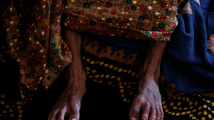 El hambre en niveles cr&iacute;ticos casi se duplica en Somalia