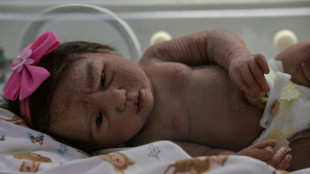 Brazil breaks out in a rash over life-like doll craze